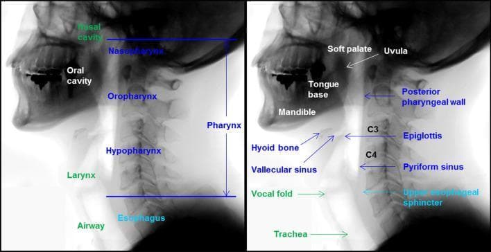 This lateral x-ray radiography shows two panels detailing the head and neck anatomy essential for the swallowing process. The diagram employs a color-coded labeling system to distinguish functional regions: white for the oral cavity, dark blue for the pharynx, green for the airway, and light blue for the esophagus. Key structures identified include the mandible, tongue base, soft palate, and uvula within the oral cavity. The pharynx is divided into three distinct segments: the nasopharynx, oropharynx, and hypopharynx, with specific landmarks such as the posterior pharyngeal wall, epiglottis, vallecular sinus, and pyriform sinus highlighted. The airway section identifies the larynx, vocal folds, and trachea. Vertebral landmarks C3 and C4 are indicated to provide spatial orientation for the pharyngeal structures and the upper esophageal sphincter. This clinical illustration serves as an educational reference for understanding the normal anatomical relationships required during a videofluoroscopic swallowing study (VFSS) and the transition of a bolus from the oral phase to the esophageal phase.