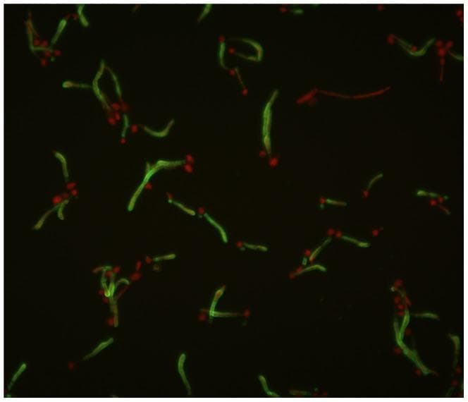 This diagnostic image is a fluorescence microscopy micrograph illustrating the morphological features of Candida albicans. The visual field demonstrates dual-color immunofluorescence staining using mAb K20 to highlight specific fungal cell wall components. Elongated, filamentous structures known as germ tubes exhibit diffuse green fluorescence along their cell walls, indicating the localization of the target antigen during hyphal transition. In contrast, smaller, oval-to-round budding yeast cells (blastospores) show concentrated red fluorescence, typically localized at points of active cellular division or budding sites. The spatial arrangement shows budding cells frequently attached to the lateral or terminal aspects of the germ tubes, representing the proliferative lifecycle of the pathogen. This image is medically significant for studying fungal pathogenesis, cell wall molecular composition, and the diagnostic identification of C. albicans through characteristic germ tube formation and specific monoclonal antibody binding patterns.