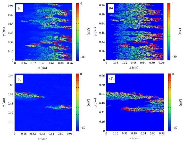 This figure presents four heat maps depicting simulated cardiac action potential wave propagation and reentry in a 1.0 cm x 1.0 cm tissue area, comparing microscopic ((a) and (c)) and discrete ((b) and (d)) models. The color scale indicates membrane potential in millivolts (mV), ranging from -80 mV (dark blue, resting state) to 0 mV (dark red, depolarization). Panels (a) and (b) show longitudinal propagation at t = 50 ms. Both models display an irregular wave front moving from left to right, characterized by high-voltage red and yellow leading edges and green/blue trailing regions, illustrating rapid conduction along myocardial fibers. Panels (c) and (d) capture the tissue at t = 160 ms, highlighting a reentry phenomenon. In the microscopic model (c), the reentrant wave appears fragmented and less extensive. In contrast, the discrete model (d) exhibits a more robust and continuous reentrant pathway, particularly visible in the central and upper-right quadrants. These simulations demonstrate how heterogeneous tissue structure and microfibrosis influence electrical dynamics, potentially leading to ectopic pacemakers and sustained arrhythmias like atrial fibrillation.