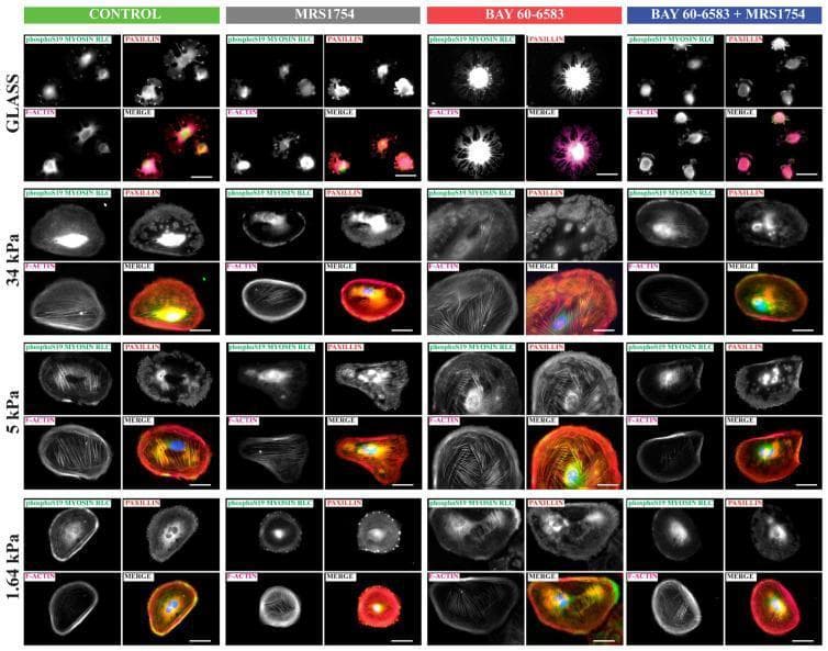 This composite of epifluorescence microscopy images illustrates the mechanobiological response of human podocytes to varying matrix stiffness (Glass, 34 kPa, 5 kPa, and 1.64 kPa) under A2B adenosine receptor (A2BAR) pharmacological modulation. The panel tracks four groups: Control, MRS1754 (A2BAR antagonist), BAY 60-6583 (A2BAR agonist), and a combined treatment. Immunofluorescent markers include phospho-S19 Myosin Light Chain (MLC) (green), Paxillin (red), and F-actin (phalloidin, magenta/white), with DAPI (blue) for nuclei. The images demonstrate that increasing matrix stiffness promotes the formation of prominent actin stress fibers and larger paxillin-positive focal adhesions. A2BAR stimulation by BAY 60-6583 enhances cell spreading and actomyosin contractility, evidenced by intensified phospho-S19 MLC and organized actin cables, particularly at intermediate stiffness (5-34 kPa). Conversely, MRS1754 antagonizes these effects, resulting in reduced cytoskeletal organization and attenuated focal adhesion development. This highlights the role of A2BAR signaling in regulating podocyte contractility and structural plasticity in response to the physical environment of the glomerular basement membrane.
