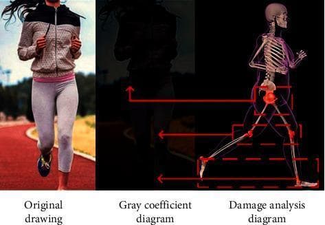 This composite educational graphic illustrates the transition from clinical observation to diagnostic injury analysis in sports medicine. It contains three side-by-side panels: an Original drawing, a Gray coefficient diagram, and a Damage analysis diagram. The 'Original drawing' is a clinical photograph showing a female runner on a track, serving as the baseline for activity monitoring. The 'Gray coefficient diagram' displays a segmented, low-contrast grayscale silhouette used for computer-aided image recognition and motion tracking. The 'Damage analysis diagram' provides a medical illustration of the runner's musculoskeletal system. This panel highlights high-stress anatomical regions susceptible to sports-related injury, specifically the hip joint (acetabulofemoral joint), knee joint (tibiofemoral joint), and ankle joint (talocrural joint). These areas are emphasized with red coloration and bounding boxes, connected via red arrows to the corresponding anatomical locations on the motion-tracking model. The image demonstrates the application of image recognition technology in identifying common student and adolescent sports injuries, focusing on joint biomechanics and physical health assessment.