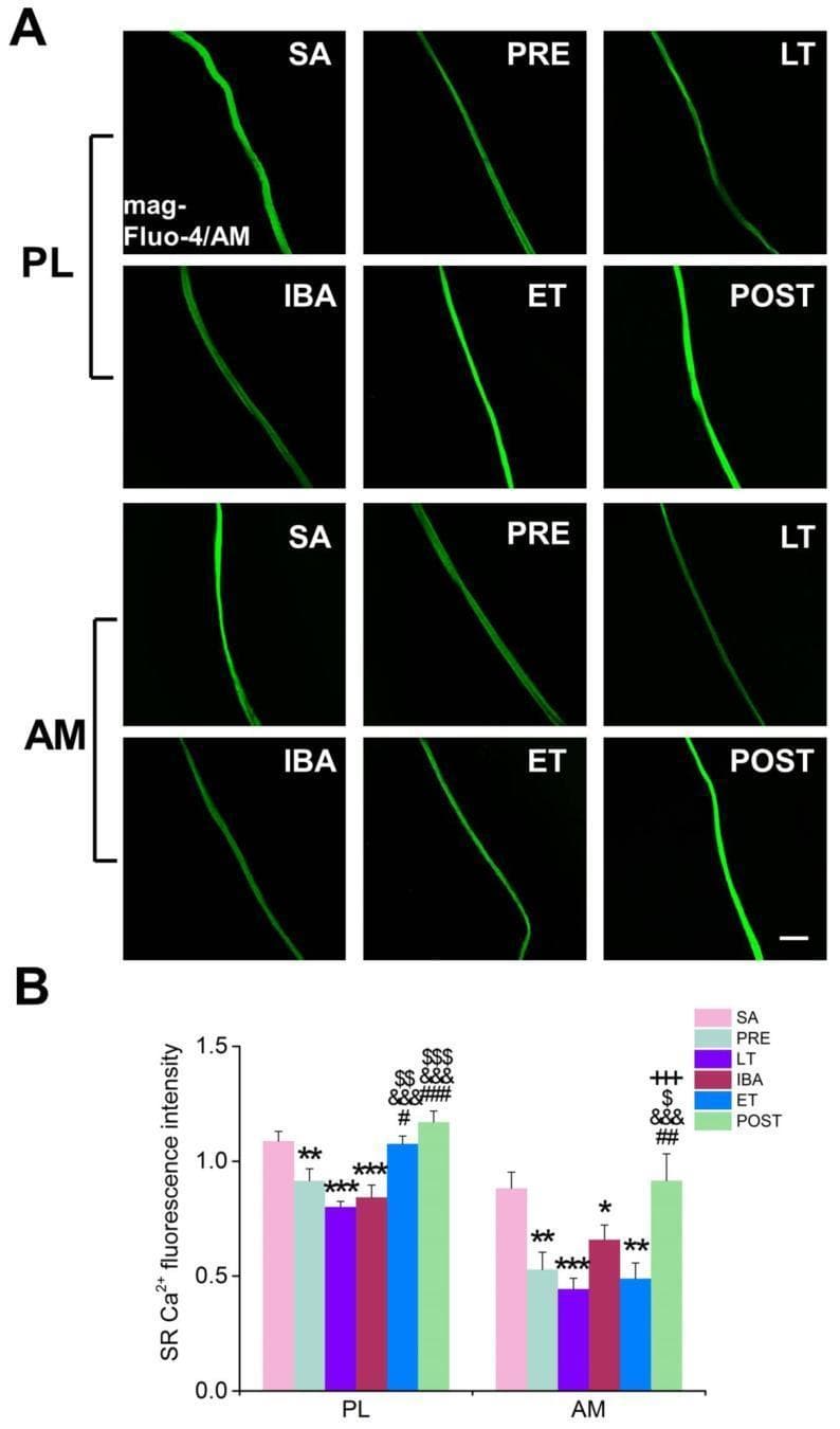 This composite educational graphic illustrates changes in sarcoplasmic reticulum (SR) Calcium (Ca2+) concentrations in skeletal muscle fibers across different physiological states. Panel A displays representative fluorescence microscopy images using mag-Fluo-4/AM staining on single muscle fibers from the plantaris (PL) and adductor magnus (AM). The green fluorescence signal qualitatively represents SR Ca2+ levels across six experimental groups: Summer Active (SA), Pre-hibernation (PRE), Late Torpor (LT), Inter-bout Arousal (IBA), Early Torpor (ET), and Post-hibernation (POST). Panel B provides a quantitative comparison through a bar histogram showing SR Ca2+ fluorescence intensity. The data reveals a significant decrease in SR Ca2+ levels during hibernation phases (LT, IBA, ET) compared to the SA and PRE groups, with substantial recovery observed in the POST group. Statistical significance is indicated by symbols (asterisks, hashtags, etc.) representing various group comparisons. This material is useful for studying muscle physiology, calcium signaling, and the cellular adaptations of skeletal muscle to metabolic shifts and environmental changes.