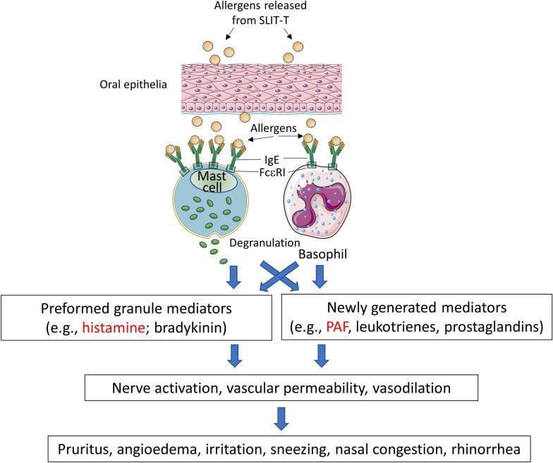 This pathophysiology diagram illustrates the biological mechanism of local allergic reactions induced by sublingual immunotherapy tablets (SLIT-T). The process begins with the release of allergens from SLIT-T into the oral epithelia. These allergens cross the epithelial barrier and bind to IgE antibodies complexed with FcεRI receptors on the surface of mast cells and basophils. This cross-linking triggers mast cell degranulation, releasing preformed granule mediators such as histamine and bradykinin. Simultaneously, it stimulates basophils to produce newly generated mediators, including platelet-activating factor (PAF), leukotrienes, and prostaglandins. The flowchart then maps these inflammatory mediators to their downstream physiological effects: nerve activation, increased vascular permeability, and vasodilation. Finally, the diagram lists the resulting clinical symptoms, such as pruritus, angioedema, irritation, sneezing, nasal congestion, and rhinorrhea. This educational resource summarizes the Type I hypersensitivity response specific to the sublingual route of allergen administration.