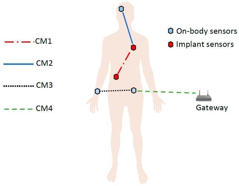 This medical technology diagram illustrates the IEEE 802.15.6 Channel Models (CM1-CM4) within a Wireless Body Area Network (WBAN) for remote patient monitoring. The visual features a human silhouette with two distinct sensor types: On-body sensors (represented by blue hexagonal icons) located on the head and waist, and Implant sensors (red hexagonal icons) situated within the torso and abdominal regions. The diagram identifies four communication pathways: CM1 (red dash-dot line) represents implant-to-implant or implant-to-body surface communication; CM2 (solid blue line) depicts on-body sensor-to-implant communication, spanning from the head to the chest; CM3 (dotted black line) shows on-body to on-body communication across the waist; and CM4 (dashed green line) illustrates off-body communication between a waist-mounted central node and an external gateway device. This figure is used in medical informatics and biomedical engineering to conceptualize data transmission architectures for real-time physiological monitoring and chronic disease management.