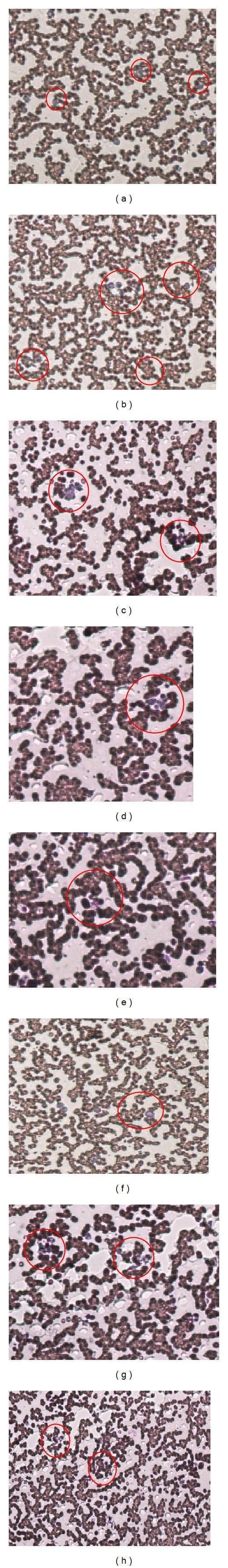 This composite diagnostic image features eight light microscopy frames (45x magnification) of blood smears, labeled (a) through (h). The primary educational focus is the qualitative assessment of platelet aggregation and blood compatibility following exposure to Berberine (BBR) in various formulations: naked nanoparticles (BBR-NNPs), surface-modified nanoparticles (BBR-SMNPs), pure BBR, and placebo controls at concentrations of 10 mcg/mL and 100 mcg/mL. Each panel shows a field of view containing evenly distributed erythrocytes (red blood cells) against a clear background. Red circular annotations are overlaid to highlight individual platelets or small clusters. Across all treatment groups and concentrations, there is a notable absence of large-scale platelet clumping or pathological aggregation, suggesting the drug delivery systems maintain hemocompatibility. The erythrocytes maintain a characteristic biconcave appearance without significant morphological alteration. This comparison chart is used in pharmacological research to demonstrate that nanocarrier surface modifications, such as Vitamin E TPGS, do not adversely affect blood cellular components.