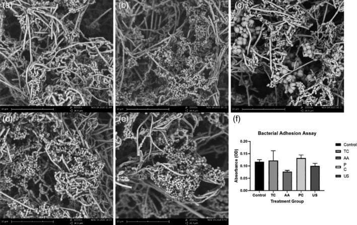 This composite educational material presents a Scanning Electron Microscopy (SEM) analysis and quantitative data regarding biofilm formation on dental zirconia surfaces. Panels (a) through (e) display high-magnification (10,000x) SEM micrographs showing the morphology of salivary bacteria on acid-etched yttria-stabilized tetragonal zirconia polycrystal (Y-TZP) discs after various decontamination treatments: (a) Untreated control, (b) titanium curette, (c) air abrasive device, (d) plastic curette, and (e) ultrasonic scaler. The images reveal a dense, complex biofilm structure characterized by spherical bacterial cells (cocci) intertwined within a fibrous, three-dimensional network of extracellular polymeric substance (EPS). Panel (f) provides a corresponding bar graph of a Bacterial Adhesion Assay, measuring bacterial numbers via optical density (OD600). The results illustrate that despite different surface instrumentation, the overall morphology and quantitative adhesion of the biofilm remain consistent across all groups. This visual is used in dental materials science and periodontology to study the effects of implant maintenance tools on bacterial colonization and biocompatibility of zirconia-based dental implants.