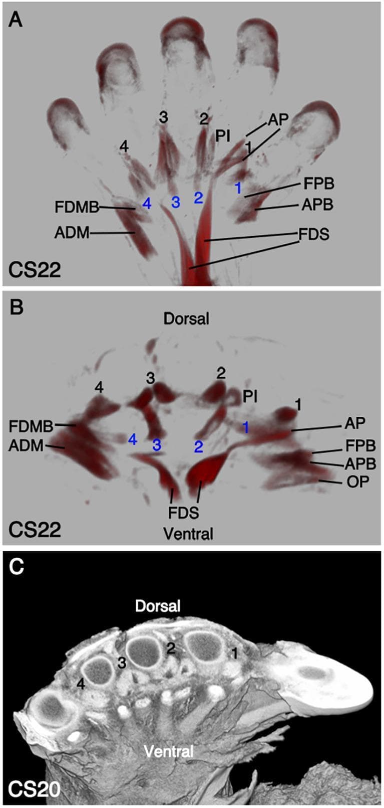 This composite educational graphic illustrates the embryonic development of human autopod (hand) musculature using Optical Projection Tomography (OPT) and high-resolution episcopic microscopy. Panel A displays a ventral view at Carnegie Stage 22 (CS22), highlighting the differentiation of intrinsic hand muscles. The thenar eminence (radial side) includes the flexor pollicis brevis (FPB), adductor pollicis (AP), and abductor pollicis brevis (APB), while the hypothenar eminence (ulnar side) shows the abductor digiti minimi (ADM) and flexor digiti minimi brevis (FDMB). The flexor digitorum superficialis (FDS) is visible with its proximal muscle belly and distal extensions. Panel B provides a distal-transverse view at CS22, showing the spatial arrangement of the four dorsal interossei (labeled 1-4 in black), palmar interossei (PI), and four lumbricals (labeled 1-4 in blue) relative to the ventral and dorsal surfaces. Panel C presents a CS20 cross-section demonstrating the anatomical relationship between developing metacarpal bones and surrounding soft tissue. This material serves as a reference for embryonic musculoskeletal development and the proximal translocation of extrinsic flexors.
