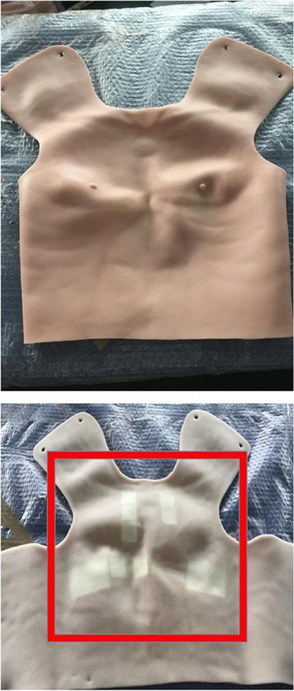 This medical educational photograph displays a prototype wearable auscultation vest designed for cardiovascular simulation. The top image shows the exterior surface of the vest, which is constructed from a skin-like, pale-toned material. It features anatomical landmarks including the suprasternal notch, clavicles, nipples, and contours representing the underlying ribcage and sternum to facilitate accurate stethoscope placement. The bottom image reveals the underside of the vest, highlighting the internal technology. Within the red box, several rectangular white panel speakers are visible, strategically adhered to the interior surface. These speakers are positioned at anatomically-standardized precordial auscultation sites to play real patient recordings of valvular heart disease sounds. The device is intended for hybrid simulation, allowing medical students to perform realistic physical examinations on standardized patients. This tool bridges the gap between theoretical knowledge of heart murmurs and clinical diagnostic skills by providing authentic auditory findings in a controlled, repeatable educational setting.
