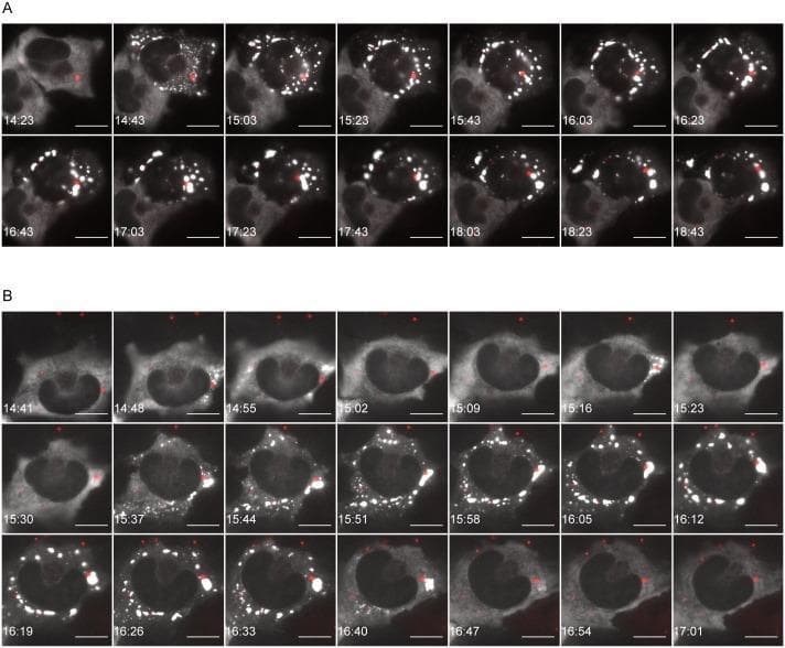 Time-lapse fluorescence microscopy of U373-MG cells infected with Rabies virus (RABV), illustrating the dynamics of stress granules (SGs) and Negri bodies (NBs). Panels A and B display two distinct temporal patterns of SG formation. The white signals represent G3BP-eGFP, a marker for SGs, while the red signals indicate P-mCherry, marking viral NBs. In cell A, a 'persistent pattern' is observed: initially diffuse cytoplasmic G3BP-eGFP (white) coalesces into bright punctate granules that increase in size through fusion and persist over several hours. In cell B, a 'transient pattern' is shown: G3BP-eGFP initially forms a peripheral ring-like structure near the cell membrane (15:30–16:26) before subsequently breaking up and losing signal intensity. Throughout both sequences, the red P-mCherry signals (NBs) appear as stable, distinct puncta, often in close proximity to but separate from the SGs. Scale bars represent 15 μm. This visualization demonstrates the liquid-droplet behavior and phase-transition properties of cytoplasmic RNA granules during viral infection.