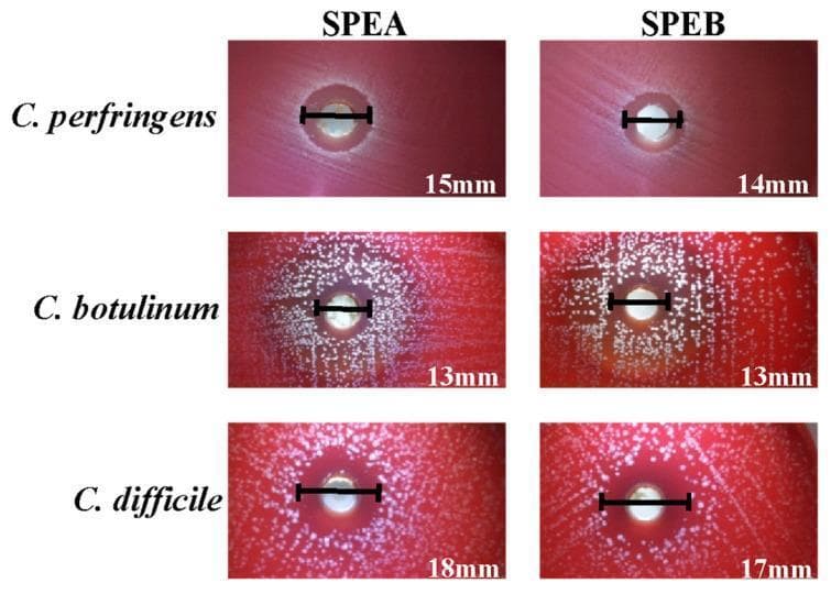 This diagnostic image showcases a series of agar well diffusion assays used for antimicrobial susceptibility testing of three clinically significant Gram-positive anaerobic bacteria: Clostridium perfringens, Clostridium botulinum, and Clostridioides difficile. The image displays a 3x2 grid of Petri dishes with blood agar medium, comparing the efficacy of two saffron petal extracts (SPEA and SPEB). Each panel illustrates an inhibition halo (zone of inhibition) surrounding a central well containing the extract. The diameter of each halo is marked with a black scale bar and measured in millimeters: for C. perfringens, SPEA (15mm) and SPEB (14mm); for C. botulinum, both SPEA and SPEB show 13mm; and for C. difficile, SPEA (18mm) and SPEB (17mm). The background shows white bacterial colonies against the red agar, with varying densities of growth. This comparison demonstrates the differential antibacterial activity of phenolic-rich extracts, where a larger halo indicates greater bacterial sensitivity, a key concept in identifying potential natural treatments for Clostridiaceae family infections.