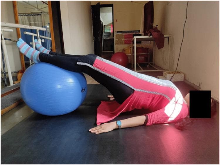 Clinical photograph of a patient performing a pelvic bridging exercise on a treatment mat, categorized under physical therapy and rehabilitation. The patient is in a supine position with the upper back and shoulders supported by the mat, while the lower limbs are elevated on a large, blue inflatable Swiss ball (stability ball). The pelvis is actively lifted into a bridge posture, demonstrating a core and pelvic floor strengthening maneuver. The patient's arms are extended laterally along the torso for stability. This exercise is designed to improve the strength and endurance of the pelvic floor muscles, gluteus maximus, paraspinal muscles, and abdominal core through gravity-resisted contraction. The image serves as a visual guide for therapeutic exercise protocols in specialties such as physical medicine, urogenital rehabilitation, and sports medicine. The setting is a clinical gym or physiotherapy clinic, indicated by the presence of parallel bars and other exercise equipment in the background.