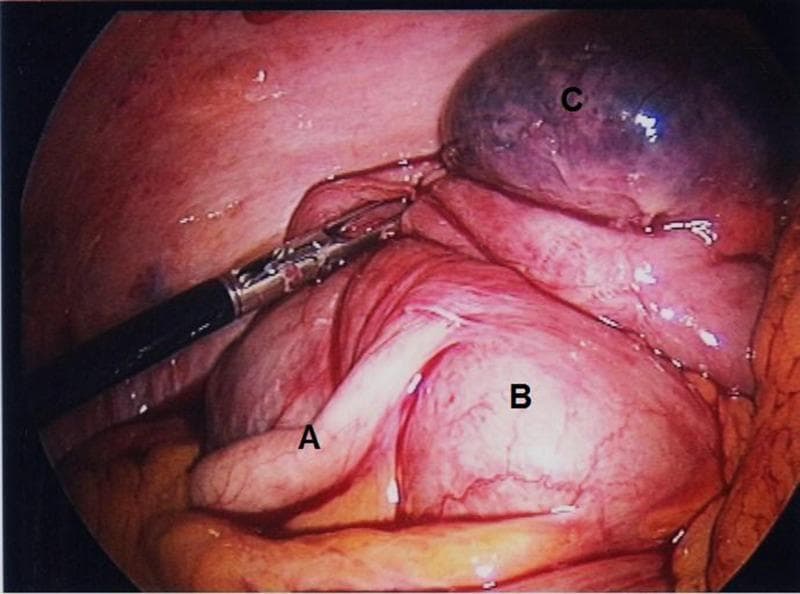 Hugging Face pmc clinical VQA raw