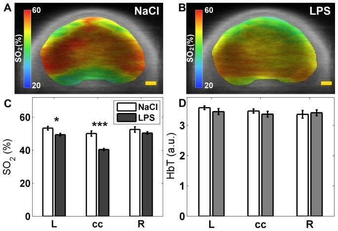 This composite educational graphic presents locoregional oxygen saturation (SO2) data in a neonatal rat brain model following lipopolysaccharide (LPS) exposure, utilizing Photoacoustic Tomography (PAT). Panels A and B display group-averaged, SO2-weighted PAT images overlaid on anatomical brain sections for sham control (NaCl) and LPS-treated groups. A colorimetric scale indicates saturation levels ranging from 20% (blue) to 60% (red). Visually, the LPS group (B) shows a shift towards green and yellow hues, indicating reduced cortical oxygenation compared to the predominantly red and orange tones in the control (A). Panel C provides a quantitative bar graph comparing SO2 percentages across three regions of interest: the left cortex (L), corpus callosum (cc), and right cortex (R). Statistically significant decreases in SO2 are noted in the LPS group (grey bars) compared to controls (white bars) in the left cortex and corpus callosum (*P<0.05, ***P<0.001). Panel D displays total hemoglobin (HbT) values, showing no significant variation between groups. This figure demonstrates the utility of PAT in monitoring metabolic and hemodynamic changes in neuroinflammatory disease models.