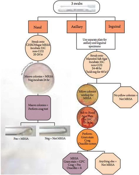 A clinical microbiology flowchart detailing the systematic isolation and identification of Methicillin-resistant Staphylococcus aureus (MRSA) from three anatomical sites: nasal, axillary, and inguinal. The nasal pathway utilizes CHROMagar MRSA, where mauve colonies indicate presumptive MRSA, followed by a confirmatory coagulase plasma test shown in test tubes. The axillary and inguinal pathways use Mannitol Salt Agar (MSA) for initial screening. Yellow colonies on MSA (indicating mannitol fermentation) are subcultured onto Blood Agar Plates for 18-24 hours. Final identification of MRSA requires a battery of tests confirming Gram-positive cocci (GPC) morphology, positive coagulase production, and oxacillin resistance via screening agar. The diagram incorporates photographs of culture plates and biochemical test results to illustrate the diagnostic criteria. This algorithm is designed for laboratory medicine and infectious disease training to demonstrate standard microbial culture protocols and differential media selection based on sample source.