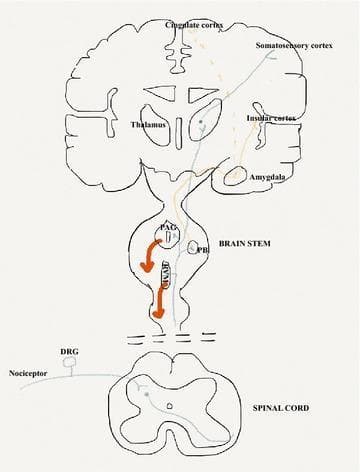 This medical anatomical diagram illustrates the neuroanatomical pathways of pain (nociception), including ascending sensory and descending modulatory systems. The diagram spans the spinal cord, brainstem, and cerebral cortex. The 'sensory-discriminative' pathway (blue line) originates from primary afferent nociceptors and the dorsal root ganglia (DRG), ascends the spinal cord to the thalamus, and terminates in the somatosensory cortex to convey stimulus location and nature. The 'affective-emotional' pathway (orange line) projects through the parabrachial nucleus (PB) in the brainstem and the amygdala, reaching the cingulate and insular cortices. Additionally, a descending inhibitory control pathway (red line/arrows) is shown originating in the periaqueductal grey (PAG) and rostroventral medulla (RVM) of the brainstem, projecting back to the spinal dorsal horn to modulate nociceptive output. This illustration serves as an educational tool for understanding the multi-dimensional processing of pain within the central nervous system.