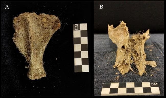 Clinical photograph of skeletal specimens demonstrating taphonomic alterations due to plant activity. Image (A) shows a scapula extensively covered by a dense, fibrous network of fine, beige-colored plant roots. The growth completely encompasses the bone, obscuring the cortical surface and demonstrating the capacity of root infiltration to colonize skeletal remains. Image (B) displays a cranium exhibiting severe destruction and fragmentation. Visible plant roots are intertwined within the cranial structure, contributing to mechanical fracturing along suture lines and erosion of the cortical and trabecular bone, particularly around the nasal and lacrimal regions. Both images include a centimeter scale for reference. These specimens illustrate the processes of post-mortem bone degradation (taphonomy) and the bioerosive role of flora in forensic and osteological contexts, specifically highlighting how plant root systems can compromise the integrity of human or comparative mammalian remains.