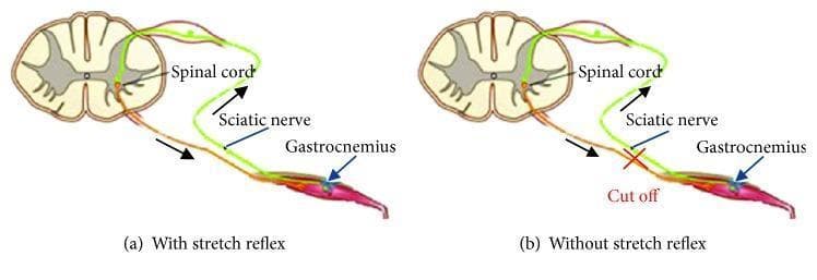 Anatomical diagrams illustrating the components of the monosynaptic stretch reflex arc in two experimental states. Both panels show a transverse section of the spinal cord (white and gray matter) connected to the gastrocnemius muscle via the sciatic nerve. Panel (a), labeled 'With stretch reflex', depicts an intact neural circuit: a sensory (afferent) pathway, colored green, carries signals from the muscle spindle to the dorsal horn, while a motor (efferent) pathway, colored orange/brown, carries impulses from the ventral horn back to the muscle. Black arrows indicate the direction of signal flow. Panel (b), labeled 'Without stretch reflex', demonstrates a disrupted circuit where the sciatic nerve has been severed, indicated by a red 'X' and the text 'Cut off'. This visualization highlights how the interruption of the peripheral nerve abolishes the reflex arc between the spinal cord and the effector muscle, commonly used in physiological studies to compare muscle response forces with and without neural feedback.