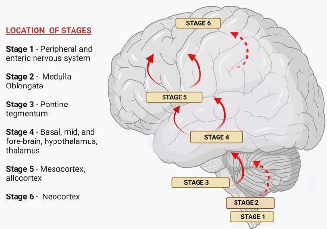 This medical illustration depicts the Braak staging system for Lewy pathology progression in Parkinson’s disease. It consists of a sagittal-view anatomical diagram of the human brain with superimposed labels and directional red arrows indicating the caudo-rostral spread of alpha-synuclein pathology. A legend titled 'LOCATION OF STAGES' describes the six stages: Stage 1 (Peripheral and enteric nervous system), Stage 2 (Medulla Oblongata), Stage 3 (Pontine tegmentum), Stage 4 (Basal, mid, and fore-brain, hypothalamus, thalamus), Stage 5 (Mesocortex, allocortex), and Stage 6 (Neocortex). The visual logic uses solid and dashed red arrows to trace the ascending pathway of neurodegeneration starting from the brainstem and progressing through subcortical structures into the higher cortical regions. This educational diagram is used in neurology and pathology to visualize the stereotypical anatomical evolution of Parkinson’s disease, correlating structural involvement with the progression from premotor to motor and eventually non-motor/cognitive symptoms.