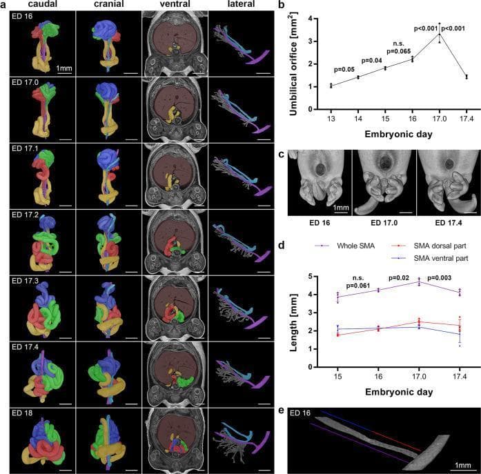 Educational medical composite illustrating the embryological 'midgut shift' in a rat model, representing mammalian intestinal development from Embryonic Day (ED) 16 to ED 18. Panel (a) presents chronological 3D reconstructions from caudal, cranial, ventral, and lateral views. Intestinal segments are color-coded by cluster (Red, Green, Blue, Yellow), and the Superior Mesenteric Artery (SMA) is highlighted in purple. The sequence captures the transition from physiological herniation (ED 16) through progressive retraction into the abdominal cavity (ED 17.0β17.3) to the final internal positioning (ED 17.4β18). Ventral views show the relationship with the liver (brown) and abdominal wall. Panels (b) and (d) provide morphometric quantitative data, graphing the umbilical orifice area and SMA length. The data indicate that the umbilical orifice reaches peak expansion at ED 17.0 before closing, while SMA length increases during the shift's tension phase and decreases upon completion (ED 17.4), signifying a 'relaxed' configuration. Panel (c) provides surface reconstructions of the umbilical region, while (e) shows isolated vessel analysis.