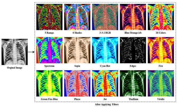 A multi-panel diagnostic comparison chart demonstrating different digital image processing filters applied to a frontal chest X-ray. The original grayscale image serves as the baseline, followed by 15 filtered variations labeled as: 5 Ramps, 6 Shades, 3-3-2 RGB, Blue Orange icb, 16 Colors, Spectrum, Sepia, Cyan Hot, Edges, Fire, Green Fire Blue, Phase, Jet, Thallium, and Viridis. The filters utilize various pseudocolor mapping and edge detection techniques to enhance different anatomical and pathological features. For instance, the 'Edges' filter highlights the cortical outlines of the ribs and spinal column, while the 'Green Fire Blue' and 'Spectrum' filters utilize high-contrast color gradients to differentiate lung parenchyma density and potential opacities. The collection illustrates how computational image enhancement is used in medical machine learning to identify thoracic pathologies such as COVID-19, pneumonia, or pulmonary nodules by accentuating specific tissue characteristics and structural boundaries.