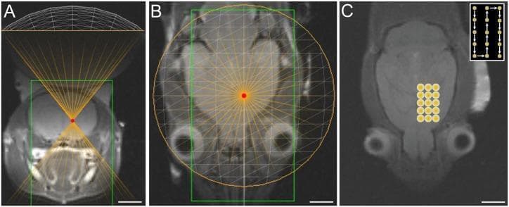 This diagnostic and planning image set illustrates MRI-guided focused ultrasound (MRgFUS) treatment planning in a rodent brain model. Panels A and B present T2-weighted MR images in coronal and axial planes, respectively, showing the focused ultrasound transducer's positioning. A white wireframe represents the transducer geometry, with orange rays converging at a specific focal point marked by a red dot within the brain's subcortical structures. A green rectangular boundary delineates the targeted treatment volume. Panel C provides an axial T2-weighted image displaying the sonication rastering protocol applied to the striatum. A grid of 15 yellow circles (3x5 arrangement) identifies the discrete sonication points. An inset diagram in the upper right corner details the serpentine sonication sequence, indicating the path and order of treatment points. The images demonstrate the spatial precision of therapeutic ultrasound targeting for neurointerventional research, specifically focusing on the striatal region.