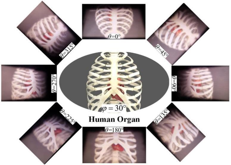 This Comparison Chart illustrates 3D light-field reconstructions of the thoracic cavity for medical diagnosis and education. The central oval image shows a clear, frontal anatomical diagram of the human rib cage and sternum with the heart positioned internally. Surrounding this central figure are eight rectangular frames displaying diagnostic-style 3D renderings of the same structures from different angular perspectives (theta, θ) in 45-degree increments from 0° to 315°. These peripheral images demonstrate the annular viewing capabilities of tabletop light-field displays, showing how the parallax shifts to reveal different facets of the heart and skeletal anatomy. The renderings emphasize depth cues and geometric relationships between the sternum, ribs, and cardiac organ. Some frames exhibit varying levels of clarity, likely to demonstrate the effects of the facet-braiding phenomenon on image quality at specific viewing angles. The content serves as a demonstration of high-fidelity volumetric rendering for biomedical visualization and virtual anatomy training.