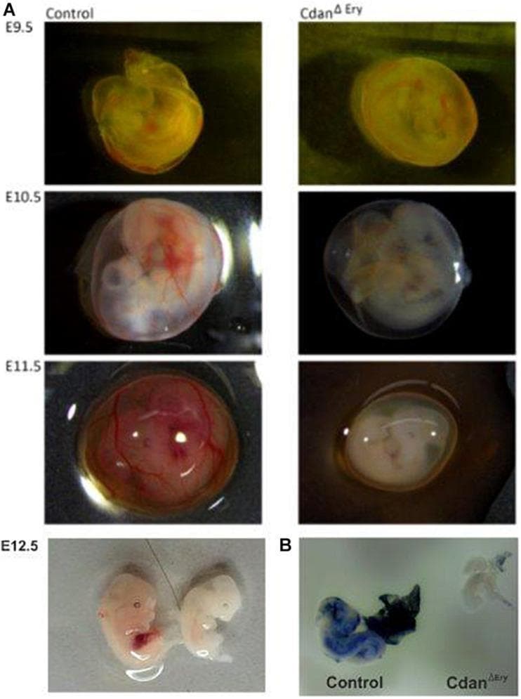 Educational comparison of mouse embryo development highlighting the phenotype of Cdan1 (Codanin-1) erythroid-specific deletion (CdanΔEry). Panel A presents a longitudinal timeline of embryos from developmental stages E9.5 to E12.5. Control embryos demonstrate physiological maturation characterized by progressive deepening of red coloration and well-defined branching vasculature, reflecting normal hemoglobinization and erythropoiesis. In contrast, CdanΔEry embryos exhibit severe anemia, appearing progressively pale and translucent from E10.5 onwards, with a complete absence of visible blood vessels and a lack of fetal liver development. Panel B displays Benzidine staining of E10.5 embryos, a histochemical method for detecting hemoglobin. The control embryo and its associated yolk sac show intense blue staining, indicating robust heme presence. The CdanΔEry mutant embryo and its yolk sac are significantly smaller and exhibit minimal to no staining, confirming severe primitive erythroid failure and anemia. This visual evidence supports the role of Codanin-1 in primitive erythropoiesis, relevant to the study of Congenital Dyserythropoietic Anemia type I (CDA-I).