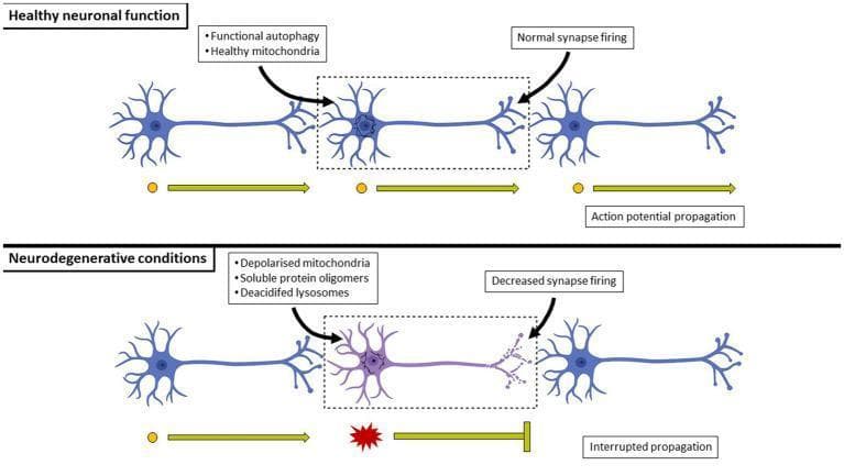 This pathophysiology diagram provides a comparative visualization of neurons under 'Healthy neuronal function' versus 'Neurodegenerative conditions'. The upper panel depicts healthy neurons with intact morphology, functional autophagy, and healthy mitochondria, which facilitate 'Normal synapse firing'. Signal transmission is represented by continuous yellow arrows labeled 'Action potential propagation', indicating efficient neurotransmission. In contrast, the lower panel illustrates the impact of neurodegenerative disease on cellular physiology. The affected neuron exhibits structural changes, including a discolored (purple) soma and fragmented axon terminals. Key pathological features highlighted include depolarized mitochondria, the accumulation of soluble protein oligomers, and deacidified lysosomes. These cellular dysfunctions result in 'Decreased synapse firing' and 'Interrupted propagation', visually represented by a broken action potential arrow with a red burst symbol and a terminal block. The diagram serves as an educational summary of how impaired proteostasis and mitochondrial health lead to the breakdown of neuronal circuits in diseases such as Alzheimer’s, Parkinson’s, and Huntington’s.