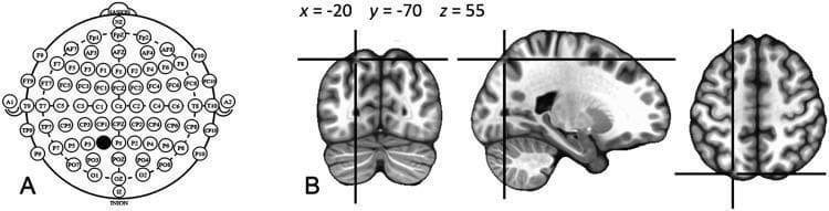 This composite educational graphic illustrates the localization of cortical stimulation targets. Panel A presents a top-down schematic diagram of the International 10-20 system for Electroencephalography (EEG) electrode placement. It displays a comprehensive grid of labeled electrode positions, including frontal (F), central (C), parietal (P), temporal (T), and occipital (O) sites. The P1 electrode position is highlighted with a black circle, indicating its selection as a stimulation target. Panel B provides a corresponding diagnostic visualization using a standardized MNI (Montreal Neurological Institute) brain template in three anatomical planes: coronal, sagittal, and axial. Crosshairs pinpoint the precise cortical projection of the P1 scalp coordinate at MNI coordinates x = -20, y = -70, z = 55, located in the posterior part of the left intraparietal sulcus (IPS). This visualization demonstrates the relationship between external scalp landmarks used in Transcranial Magnetic Stimulation (TMS) and underlying neuroanatomical structures, serving as a methodological guide for neuroimaging and brain stimulation research.