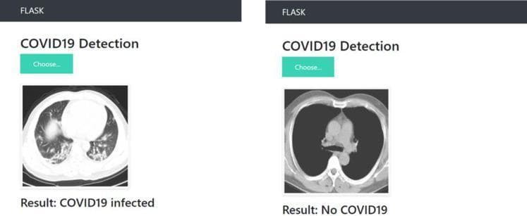 This comparison chart displays two axial computed tomography (CT) scans of the human chest within a web-based diagnostic application interface. The left panel shows a CT scan labeled 'COVID19 infected,' demonstrating significant pulmonary pathology. Key findings include bilateral, peripheral, and basal ground-glass opacities (GGO) with patchy distribution and some areas of subpleural consolidation, which are characteristic of viral pneumonia. These opacities appear as hazy, increased lung density that does not obscure underlying vascular structures. In contrast, the right panel shows a CT scan labeled 'No COVID19,' representing a normal diagnostic image. This scan shows clear, air-filled lung parenchyma with uniform low density and sharply defined pulmonary vessels and mediastinal structures. The visual comparison serves as an educational tool for identifying radiological hallmarks of COVID-19 pneumonia versus healthy lung tissue. The content is suitable for intermediate medical education, focusing on diagnostic radiology and pulmonary infectious diseases.