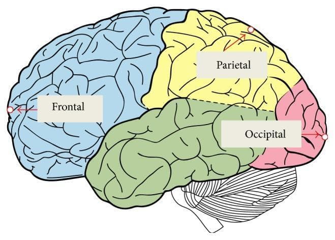 This anatomical diagram provides a lateral view of the human brain, illustrating the major cerebral lobes and their spatial relationships. The diagram uses distinct color-coding to differentiate the lobes: the frontal lobe (light blue), the parietal lobe (yellow), the temporal lobe (green), and the occipital lobe (pink). The surface of the cerebral cortex is depicted with highly convoluted patterns representing the characteristic gyri and sulci. Three anatomical landmarks are indicated with red arrows and white circular nodes, corresponding to specific regions used for intracranial pressure monitoring or finite element modeling: the anterior frontal pole, the superior parietal cortex, and the posterior occipital pole. Below the temporal and occipital lobes, the cerebellum is visible with its distinct folia pattern, alongside the upper portion of the brainstem. The illustration serves as a reference for neuroanatomical segmentation, often utilized in biomechanical simulations and functional magnetic resonance imaging (fMRI) studies to investigate pressure distribution and brain injury criteria.