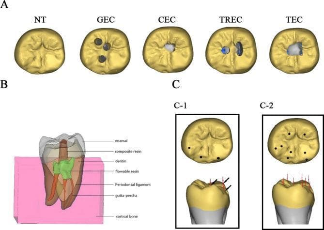 This composite educational diagram presents finite element analysis (FEA) models of a mandibular molar, focusing on endodontic cavity preparation techniques and biomechanical force loading. Section A displays five occlusal views comparing different access cavity designs: Natural Tooth (NT), Guided Endodontic Cavity (GEC) with three small circular access points, Contracted Endodontic Cavity (CEC), Truss Endodontic Cavity (TREC) with isolated access holes, and Traditional Endodontic Cavity (TEC) showing a large central access. Section B provides a sagittal cross-section illustrating the anatomical and restorative components of the model, including enamel, dentin, composite resin, flowable resin, gutta-percha, periodontal ligament, and cortical bone. Section C illustrates force load patterns: C-1 shows a 3-point loading protocol simulating normal mastication with combined vertical and 45-degree lateral forces at the cusps; C-2 shows an 8-point vertical loading protocol simulating maximum bite force. This resource is designed for dental students and endodontists to evaluate how conservative versus traditional access cavities affect stress distribution and fracture resistance.
