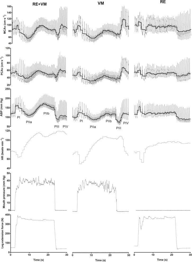 This physiological comparison chart illustrates the hemodynamic and cardiovascular responses across three distinct conditions: combined Resistance Exercise and Valsalva Maneuver (RE+VM), Valsalva Maneuver (VM) in isolation, and isometric Resistance Exercise (RE) in isolation. The visual data is presented in a multi-paneled layout tracking variables over a 30-second timeline. Key parameters include Middle Cerebral Artery blood velocity (MCAv), Posterior Cerebral Artery blood velocity (PCAv), Arterial Blood Pressure (ABP), Heart Rate (HR), Mouth Pressure (indicating strain intensity), and Leg Extension Force. For the RE+VM and VM conditions, the four classic phases of the Valsalva maneuver (PI through PIV) are clearly annotated on the ABP trace, showing the initial pressure spike (PI), subsequent decline (PIIa), partial recovery (PIIb), and post-strain fluctuations (PIII, PIV). The thick black lines represent mean values per cardiac cycle. This chart is a critical educational resource for understanding autonomic cardiovascular control, cerebral blood flow regulation, and the additive hypertensive effects of performing a Valsalva maneuver during resistance training.