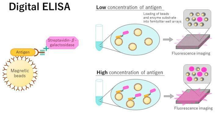 This pathophysiology diagram illustrates the principles of a Digital ELISA (Enzyme-Linked Immunosorbent Assay), an ultrasensitive diagnostic technique for single-molecule detection. The left panel details the molecular complex: an antibody-conjugated magnetic bead captures a target antigen, which is then bound by a secondary antibody labeled with Streptavidin-β-galactosidase. The right panel demonstrates the workflow and comparative analysis for low versus high antigen concentrations. Initially, mixed complexes are loaded into a femtoliter-volume microwell array designed to isolate single beads. Following the addition of a fluorogenic substrate, the array is analyzed via fluorescence imaging. In 'Low concentration' scenarios, most wells remain dark as beads lack the target antigen; in 'High concentration' scenarios, a larger percentage of wells exhibit fluorescent signals (pink bursts). The concentration of the target protein in the clinical sample is quantitatively determined by the ratio of 'on' (fluorescent) to 'off' (non-fluorescent) wells, enabling much higher sensitivity than conventional bulk ELISAs for detecting trace biomarkers.