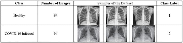 A comparison chart and diagnostic image summary detailing a dataset for automated respiratory disease classification. The table is divided into two primary categories: 'Healthy' (Class Label 1) and 'COVID-19 infected' (Class Label 2), each containing 94 images for a total of 188 chest X-rays. The 'Samples of the Dataset' column provides a side-by-side visual comparison of posterior-anterior (PA) chest radiographs. The 'Healthy' images demonstrate clear lung fields with distinct costophrenic angles and normal bronchovascular markings. In contrast, the 'COVID-19 infected' samples exhibit characteristic radiological abnormalities, including increased pulmonary opacity, hazy ground-glass opacities, and patchy consolidation across the lung parenchyma, which are hallmark signs of viral pneumonia. This visual representation serves to illustrate the feature differences utilized in machine learning models for detecting COVID-19 manifestations in clinical imaging.