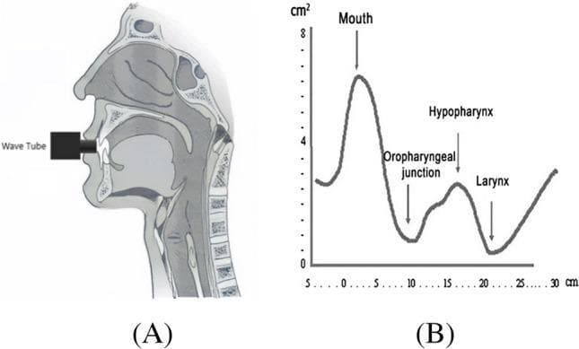 This educational composite visual illustrates acoustic pharyngometry, a non-invasive diagnostic method used to evaluate the upper airway anatomy, particularly in the context of Obstructive Sleep Apnea (OSA). Figure A is a sagittal anatomical diagram showing a wave tube inserted into the oral cavity. Visible landmarks include the nasal cavity, hard and soft palates, tongue, oropharynx, hypopharynx, larynx, and trachea, with the cervical vertebrae providing a posterior border. Figure B is a corresponding line graph plotting the airway cross-sectional area (cm²) against the distance from the mouth (cm). The graph identifies key diagnostic landmarks: a peak at the mouth (~7 cm²), a primary narrowing at the oropharyngeal junction (approx. 10 cm), a secondary widening at the hypopharynx, and a final constriction at the level of the larynx (~21 cm). This tool is clinically relevant for screening anatomical predispositions to airway collapse during wakefulness by identifying specific regions of reduced diameter or increased compliance within the respiratory tract.