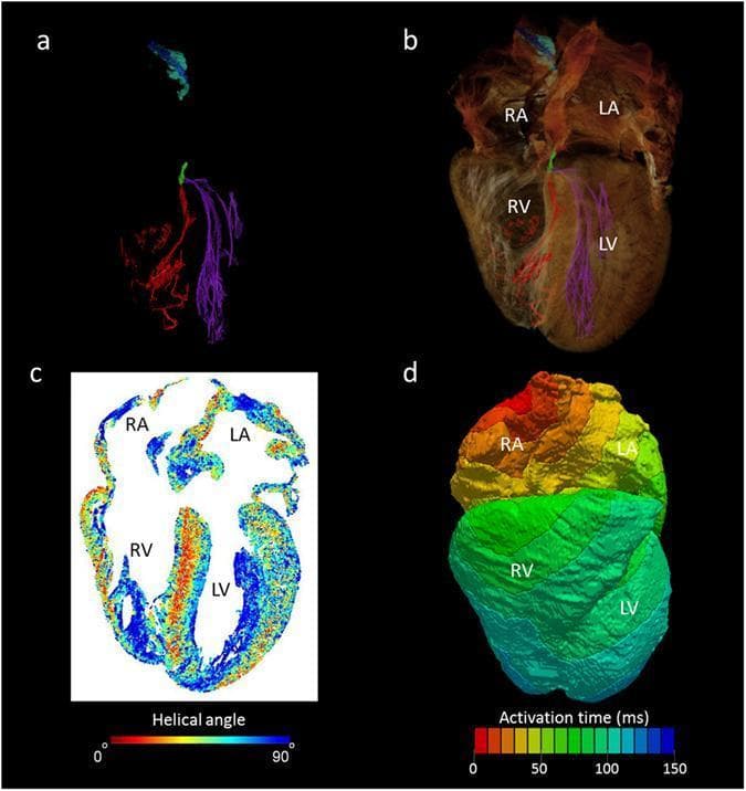 This multi-panel figure illustrates the application of high-resolution micro-CT data in mathematical modeling of human cardiac anatomy and electrophysiology. Panel (a) presents a segmented 3D reconstruction of the cardiac conduction system, color-coded to show the sinus node (blue), paranodal area (turquoise), atrioventricular (AV) conduction axis (green), and the intricate right (red) and left (purple) Purkinje networks. Panel (b) overlays these segmented structures onto a semi-transparent 'ghosted' volume rendering of the whole heart, providing anatomical context within the right and left atria (RA, LA) and ventricles (RV, LV). Panel (c) provides a four-chamber cross-sectional view of cardiomyocyte orientation, using a color map to represent absolute helical angles (0° to 90°). This reveals complex transmural patterns and longitudinal alignment in the papillary muscles. Panel (d) shows a computer-generated isochrone map of cardiac depolarization (activation time in ms) seeded from the sinus node. This visualization integrates anatomically accurate geometry with electrophysiological measurements to demonstrate physiological conduction pathways across the myocardium.