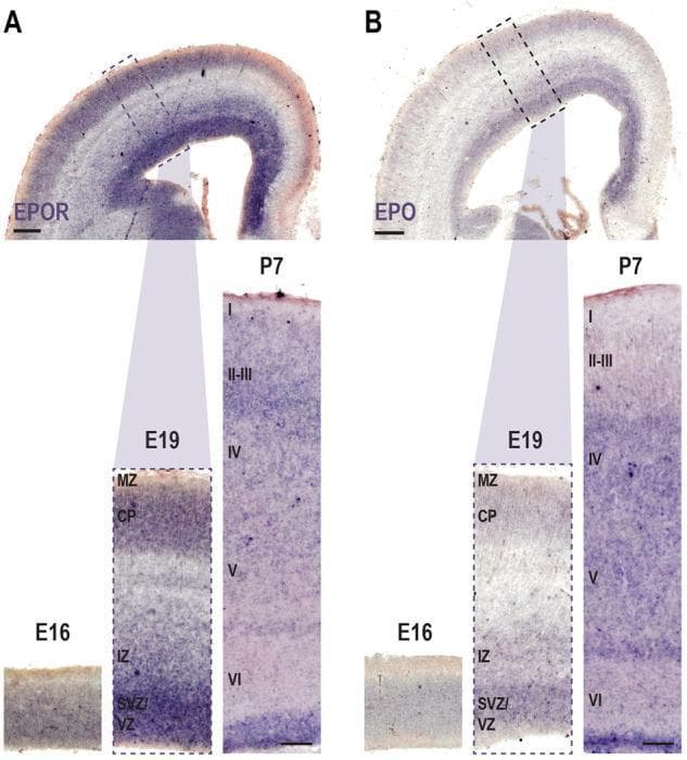 This diagnostic image illustrates the spatial and temporal expression patterns of Erythropoietin (EPO) and its receptor (EPOR) in the developing mammalian (rat) somatosensory cortex using in situ hybridization (ISH). The panels are divided into EPOR (A) and EPO (B) across three developmental stages: Embryonic day 16 (E16), E19, and Postnatal day 7 (P7). At E16, both transcripts show generalized expression, except in the marginal zone (MZ). By E19, a more differentiated laminar pattern emerges; EPOR and EPO labeling is concentrated in the ventricular zone (VZ), subventricular zone (SVZ), lower intermediate zone (IZ), and cortical plate (CP). At P7, coronal sections and high-magnification cortical columns demonstrate layer-specific distribution. EPOR is prominently expressed in the upper cortical layers and proximal to the ventricle, whereas EPO transcript peaks in deep layers (V-VI) and the periventricular area. These images highlight the regulatory role of EPO signaling during radial neuronal migration and the formation of the barrel cortex. Labels identify anatomical zones (MZ, CP, IZ, SVZ, VZ) and postnatal cortical layers (I-VI).