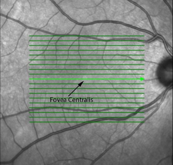 This en-face Scanning Laser Ophthalmoscopy (SLO) image provides a grayscale topographic view of the fundus, commonly used as a reference for Optical Coherence Tomography (OCT) scanning. The image depicts the posterior pole of the retina, including the macula and optic disc. The fovea centralis is visualized as a centrally located, relatively hyporeflective (darker) circular area compared to the surrounding parafoveal tissue, marked here with a black arrow and label. To the right of the macula, the optic disc appears as a vertically oriented, darker oval structure where the major retinal vasculature converges. The retinal blood vessels are visible as dark, branching tubular structures emerging from the optic nerve head and traversing the retinal surface. A series of green horizontal lines are overlaid across the macular region, representing the acquisition grid and specific scan locations (B-scans) for sectional OCT imaging. This imaging modality is essential for anatomical localization and quantitative measurement of retinal structures like the fovea in relation to the optic nerve head.