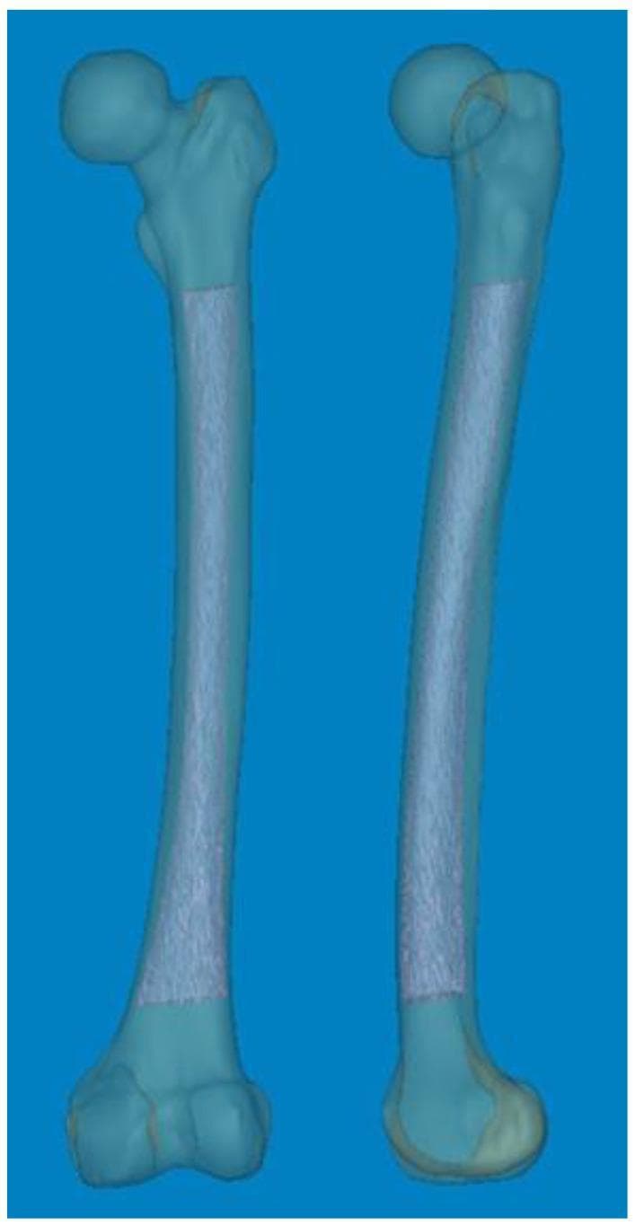 This diagnostic visualization features two 3D anatomical reconstructions of a human femur, created from CT data using Mimics® software. The models demonstrate the full anatomy of the femur, including the femoral head, neck, greater and lesser trochanters, the diaphyseal shaft, and the distal condyles. The model on the left is presented in an anterior-posterior (coronal) view, while the model on the right is shown in a lateral (sagittal) view, highlighting significant anterior bowing of the femoral shaft. A key feature of these models is the visualization of the medullary canal, rendered as a semi-transparent, textured internal volume extending through the diaphysis to the distal metaphysis. This 3D representation is utilized in orthopedic surgical planning, specifically for analyzing femoral shaft bowing (FSB) and determining the mechanical axis (MA) to optimize component alignment in total knee arthroplasty (TKA) and revision surgeries.