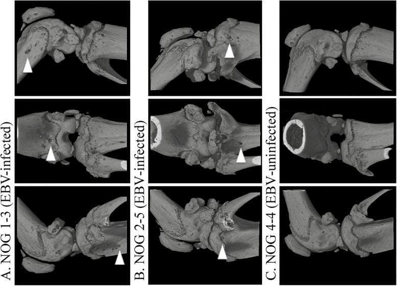 Three-dimensional computed tomography (3D-CT) comparison of mouse knee joints in a model of erosive arthritis related to Epstein-Barr virus (EBV) infection. The figure is divided into three columns representing EBV-infected subjects (A and B) and an EBV-uninfected control (C), with multiple anatomical views for each. Column A and B display significant pathological changes in the bone architecture of humanized NOG mice. White arrowheads highlight focal bone erosions, visible as irregular pitting, cortical discontinuity, and structural breakdown at the distal femur and proximal tibia. These morphological features resemble the erosive changes seen in Rheumatoid Arthritis (RA). In contrast, column C displays the control joint, characterized by smooth, intact cortical surfaces and a preserved joint space without signs of osseous degradation. This diagnostic imaging serves to demonstrate the development of virus-induced erosive joint disease and the role of humanized immune cells in bone resorption.