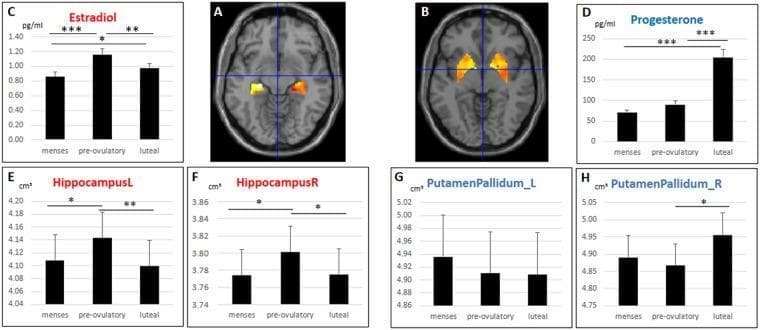 This composite educational figure illustrates structural changes in subcortical brain regions across three menstrual cycle phases: menses, pre-ovulatory, and luteal. (A) and (B) show axial structural MRI slices with heat-map overlays highlighting the regions of interest (ROIs): the bilateral hippocampus (A) and the bilateral putamen/pallidum within the basal ganglia (B). (C) and (D) are bar graphs tracking mean serum hormone levels, showing estradiol peaks during the pre-ovulatory phase and progesterone peaks during the luteal phase (p < 0.001). (E) through (H) provide longitudinal data on regional gray matter (GM) volume. Graphs E and F demonstrate that both left and right hippocampal GM volumes significantly increase during the pre-ovulatory phase compared to menses and luteal phases, correlating with estradiol peaks. Graphs G and H show volumes for the putamen/pallidum, with the right side showing a significant volume increase during the luteal phase compared to the pre-ovulatory phase, driven by progesterone. Error bars represent standard errors, and significance levels are indicated by asterisks (*p < 0.05, **p < 0.01, ***p < 0.001).