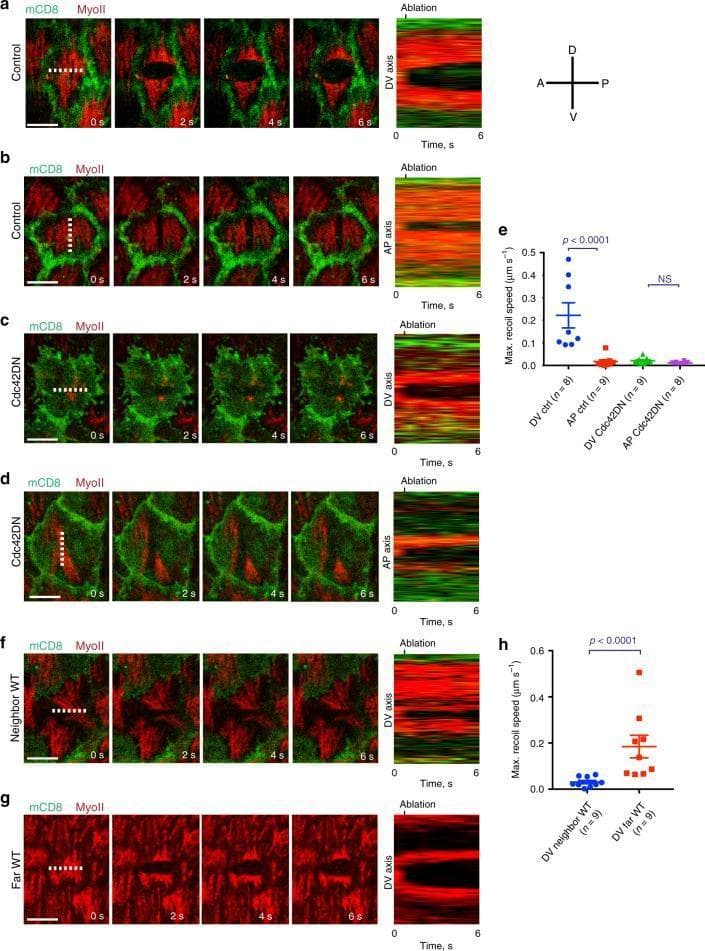 This composite diagnostic and pathophysiology diagram illustrates the role of Cdc42 in regulating cortical tension anisotropy in Drosophila follicle cells. The panel consists of time-lapse fluorescence microscopy series (0s to 6s), kymographs, and quantitative dot plots.
Fluorescence images show the distribution of MyoII (red) and mCD8 (green) before and after laser ablation (dashed lines). In control cells (a, b), ablation along the anterior-posterior (AP) axis results in a rapid recoil along the dorsal-ventral (DV) axis, visualized by the significant widening of the gap in kymographs. Conversely, ablation along the DV axis produces minimal AP recoil, demonstrating high tension anisotropy. In Cdc42-dominant negative (Cdc42DN) expressing cells (c, d), MyoII distribution is disorganized, and recoil speed is significantly reduced in both axes, indicating a loss of cortical tension.
Quantitative plots (e, h) confirm these findings, showing a statistically significant decrease (p < 0.0001) in maximum recoil speed for Cdc42DN and neighboring wild-type (WT) cells compared to distant WT cells. This demonstrates both cell-autonomous and non-cell-autonomous roles for Cdc42 in establishing the supracellular actomyosin contractile network required for tissue elongation.