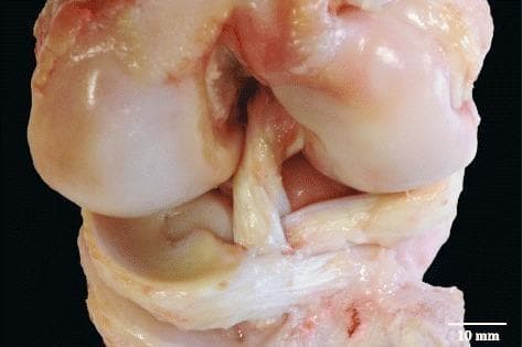 A clinical photograph of a dissected porcine (pig) stifle joint, serving as a comparative anatomical model for the human knee. The image illustrates the complex spatial relationship between the cruciate ligaments and meniscal attachments. Specifically, it demonstrates the two distinct fiber bundles of the anterior cruciate ligament (ACL) which are physically separated by the interposition of the anterior horn of the lateral meniscus. The ACL bundles exhibit a characteristic white-to-yellowish fibrous texture, while the meniscal tissue appears more translucent and slightly yellow. The underlying tibial plateau and femoral condyles are visible, providing anatomical context for the ligamentous insertions. This visual resource is used to teach comparative anatomy and to understand the variations in ligamentous and fibrocartilaginous arrangements within mammalian joints, highlighting the structural differences in meniscal anchoring between species.
