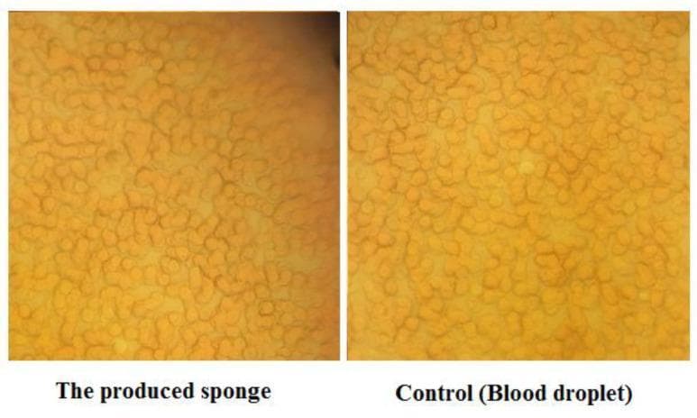 This diagnostic image provides a side-by-side comparison of red blood cell (RBC) morphology viewed under light microscopy at 100x magnification. The left panel shows RBCs within a produced gelatin sponge matrix, while the right panel serves as a control showing a standard blood droplet. Both images display a dense field of closely packed, circular to slightly oval erythrocytes characterized by a uniform yellowish-orange hue. In the gelatin sponge sample, the RBCs maintain their healthy, biconcave-typical morphology without signs of toxicity or structural deformation, though they exhibit a subtle increase in cellular clumping compared to the more even distribution in the control. A slightly darker background in the sponge sample suggests the presence of the cross-linked gelatin matrix. This comparison is used to evaluate the biocompatibility of hemostatic sponge materials and their interaction with cellular blood components during the coagulation process.
