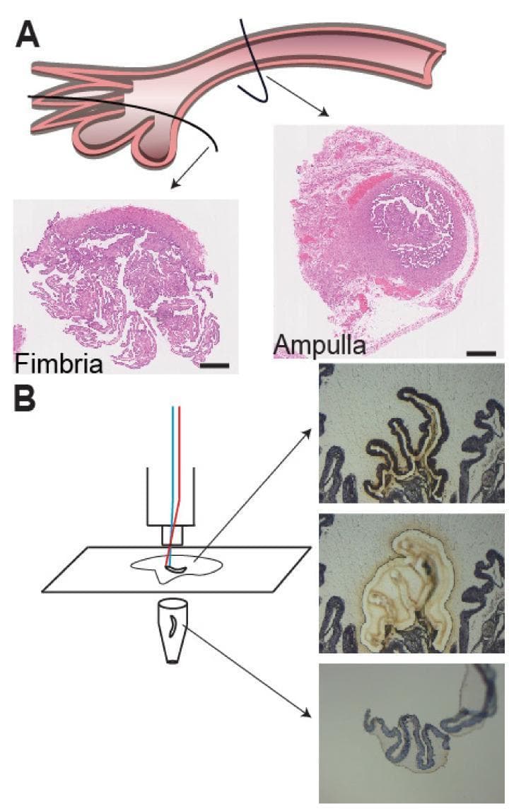 Educational composite image detailing fallopian tube histology and tissue processing. Panel A presents an anatomical diagram of the fallopian tube with arrows indicating two distinct regions: the distal fimbria and the more proximal ampulla. Corresponding Hematoxylin and Eosin (H&E) stained cross-sections are shown for each. The fimbria micrograph displays a highly complex, ruffled architecture with numerous branching papillary projections. In contrast, the ampulla micrograph shows a more defined circular profile with a central lumen and more consolidated wall structure. Panel B illustrates the Laser-Capture Microdissection (LCM) workflow used for RNA isolation. A schematic shows a laser targeting a tissue section on a PEN membrane slide, collecting the sample into a microcentrifuge tube. A series of three sequential images demonstrate the technique: the first shows the initial epithelial fold selected (marked by a dark outline), the second shows the tissue after the laser cut (appearing lighter), and the final image shows the isolated epithelium captured in the collection tube, leaving a void in the original tissue section. Scale bar: 5 mm.