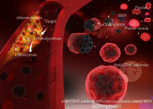 This medical illustration depicts a pathophysiology diagram of a therapeutic nanotechnology approach for treating atherosclerosis. The visual is divided into a longitudinal cross-section of a blood vessel and a detailed view of the microscopic components. The vessel shows a prominent atherosclerotic plaque characterized by a heterogeneous, lipid-rich core with internal cellular debris, causing significant luminal narrowing. Circulating within the vessel are red blood cells and various engineered nanoparticles. Key labeled components include mesoporous silica nanoparticles (MSN), shown as dark porous spheres; aCD47@MSN, representing MSN loaded with anti-CD47 antibody; and platelets/platelet vesicles. The primary therapeutic entity is the 'Anti-CD47 antibody@Platelet membrane coated MSN' (aCD47@PMSN), which consists of an antibody-loaded MSN core encapsulated in a semi-transparent red platelet membrane shell. Directional arrows illustrate the therapeutic mechanism: 'Targeting' of the plaque by aCD47@PMSN, 'Antibody release' into the lesion, and subsequent 'Efferocytosis' (clearance of necrotic cells). This diagram represents a biomimetic drug delivery system designed for cardiovascular intervention and immune-mediated plaque stabilization.