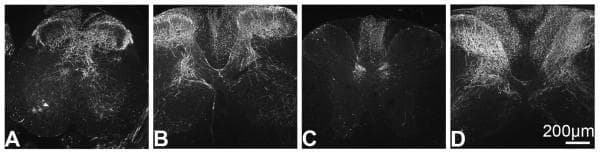 Fluorescence microscopy images depicting green fluorescent protein immunoreactivity (GFP-ir) in transverse sections of a mouse spinal cord across four anatomical levels: (A) sacral, (B) lumbar, (C) thoracic, and (D) cervical. This diagnostic series illustrates the rostral-caudal distribution of viral vector-mediated gene expression (rAAV5-GFP) following intrathecal administration. In the sacral and lumbar sections, GFP signal is dense throughout the gray matter, notably in the dorsal and ventral horns. The thoracic section shows more restricted labeling, primarily localized to the dorsal columns and Clarke's columns. In the cervical section, there is prominent GFP expression in the dorsal horn. Across all levels, the signal is primarily associated with nerve fibers, likely representing central processes of primary afferent neurons. A notable absence of signal is observed in the substantia gelatinosa (lamina II) of the dorsal horn. This visual demonstrates the efficacy of gene delivery techniques in neuroanatomy and pain research.