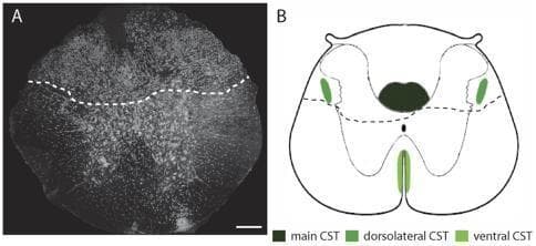 This figure provides a detailed anatomical and schematic overview of a dorsal hemisection of the thoracic spinal cord (T8 level), focusing on the corticospinal tract (CST). Panel A is a confocal microscopy image of a spinal cord cross-section counterstained with Neurotrace. A white dashed line delineates the lesion border, showing a clear separation between the dorsal area affected by the hemisection and the intact ventral region. Panel B is a corresponding schematic diagram illustrating the anatomical distribution of CST components. It highlights the main CST (dark green) located at the base of the dorsal funiculus, the dorsolateral CST (medium green) in the lateral funiculus, and the ventral CST (light green) near the ventral midline. The dashed line in the schematic reflects the lesion from Panel A, demonstrating that a dorsal hemisection interrupts the main and dorsolateral CST components while leaving the ventral CST spared. This visual is designed to teach the structural consequences of spinal cord injury on descending motor pathways.