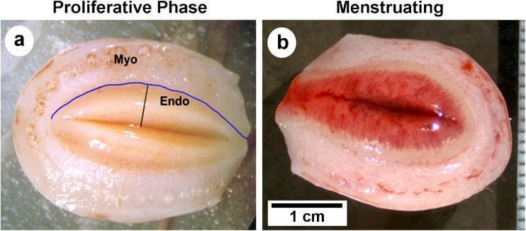 A side-by-side comparison of two macroscopic cross-sections of a rhesus macaque uterus, demonstrating physiological changes during the menstrual cycle. Image (a) represents the proliferative phase (day 14), showing a thickened endometrium (Endo) with a pale tan-to-pink hue. A clear blue line highlights the smooth, well-defined endometrial-myometrial border, with the underlying myometrium (Myo) clearly visible. Image (b) represents the second day of the menstrual phase, where the endometrium appears significantly thinner due to tissue sloughing and breakdown. In this phase, the upper third of the endometrium (functionalis zone) is visibly engorged with blood, exhibiting a deep red, hemorrhagic appearance, while the basalis layer remains intact. The endometrial-myometrial junction in the menstruating specimen is less distinct compared to the proliferative phase. A 1 cm scale bar is provided for reference. This comparison illustrates the cyclic changes in endometrial thickness, vascularity, and tissue integrity characteristic of menstruating primates.